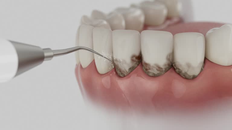 Reliable Dental contractor in Monrovia, MD by Smile Center Dentistry